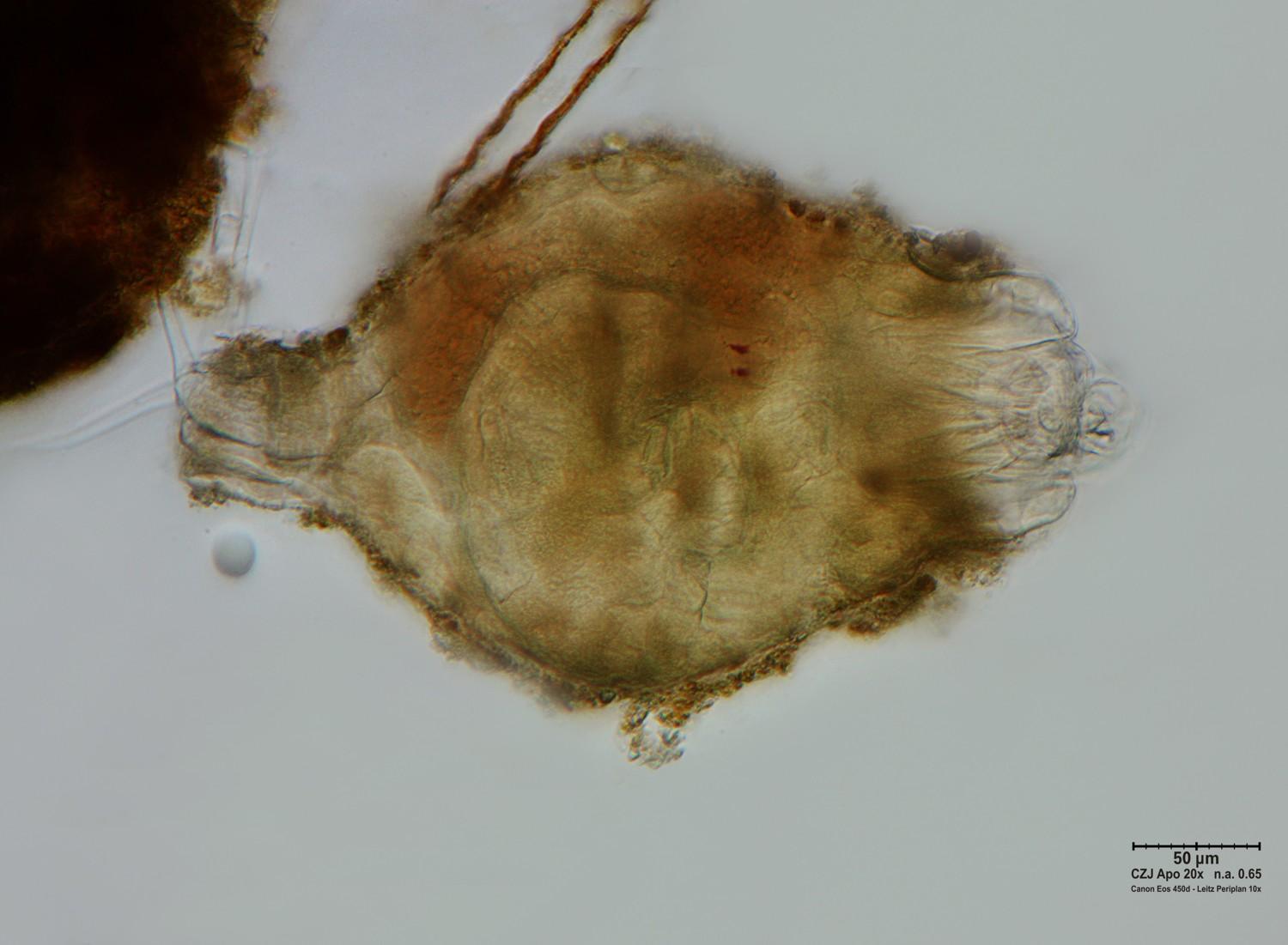 Rotifero da identificare